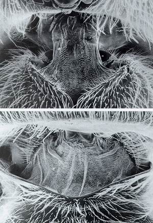 蜂王的形态显微图